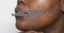 hyperpigmentation